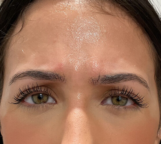 Case # 17 before photo