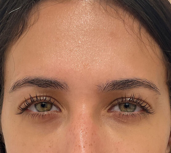 Case # 17 after photo