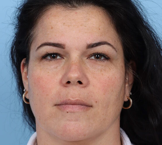 Case # 18 before photo