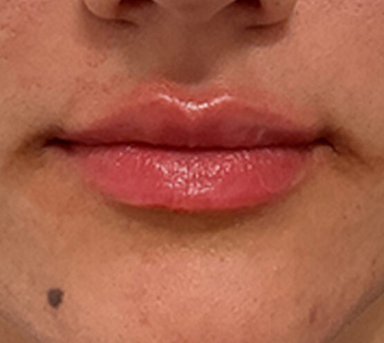 Case # 19 after photo