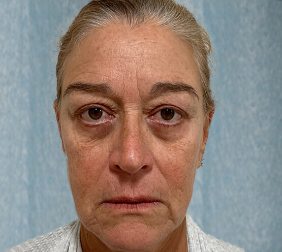 Case # 20 before photo