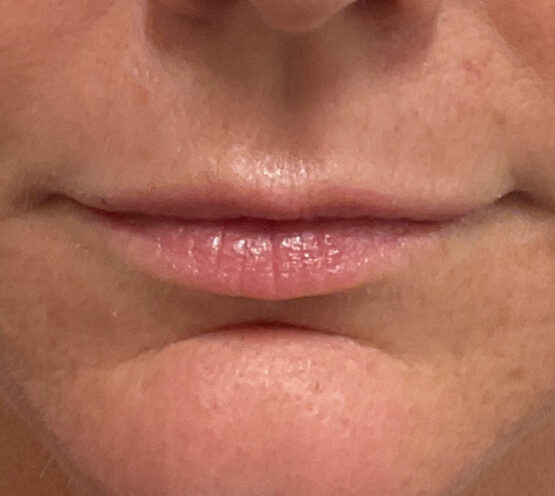 Case # 21 before photo