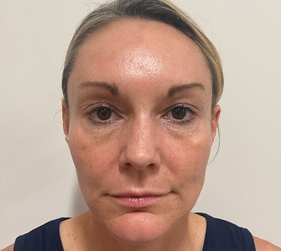 Case # 22 before photo