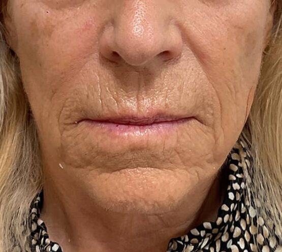 Case # 23 before photo