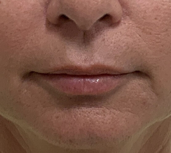 Case # 24 before photo