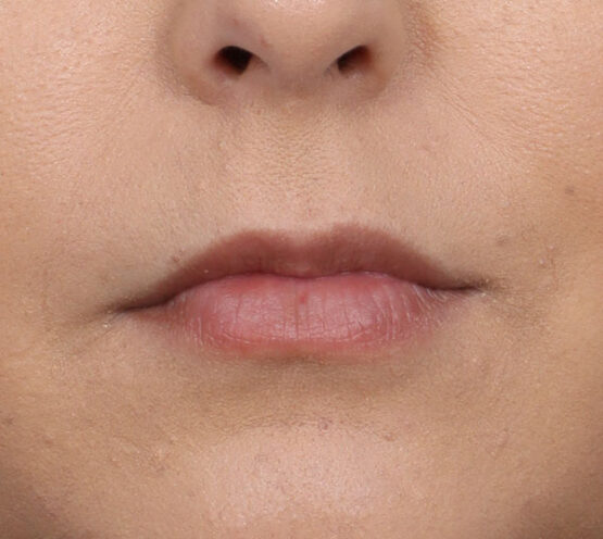 Case # 26 before photo