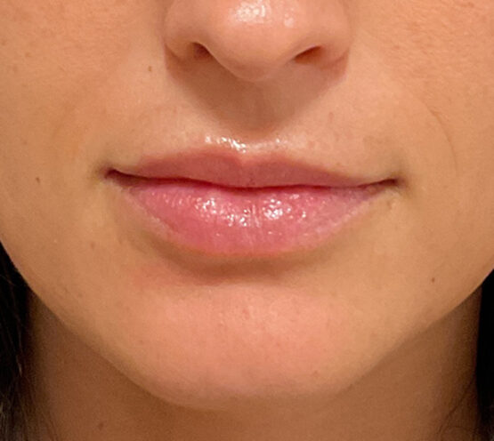 Case # 27 before photo