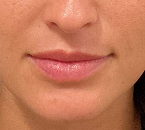 Case # 27 after photo