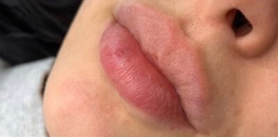 Case # 1 before photo