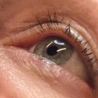 Case # 2 before photo