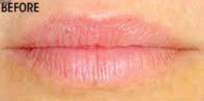 Case # 3 before photo