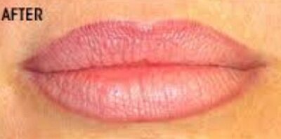 Case # 3 after photo