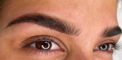 Case # 4 before photo