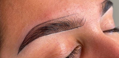 Case # 4 after photo