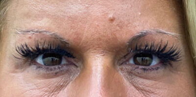 Case # 6 before photo