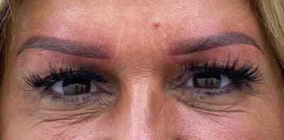 Case # 6 after photo