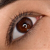 Case # 7 before photo