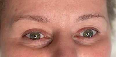 Case # 8 before photo