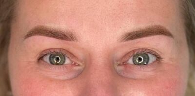 Case # 8 after photo