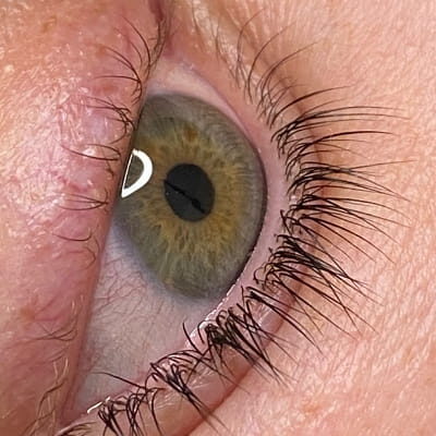 Case # 9 before photo