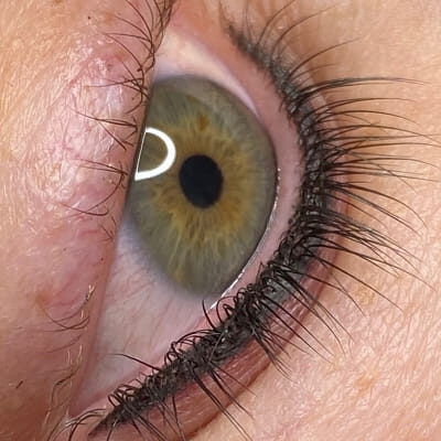 Case # 9 after photo