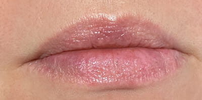 Case # 10 before photo