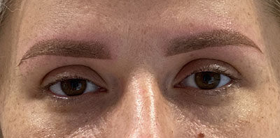 Case # 11 after photo