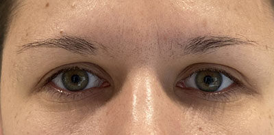 Case # 12 before photo