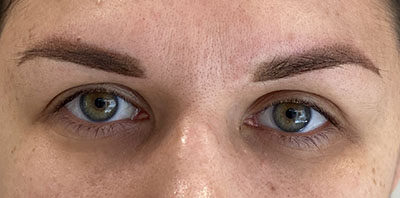 Case # 12 after photo