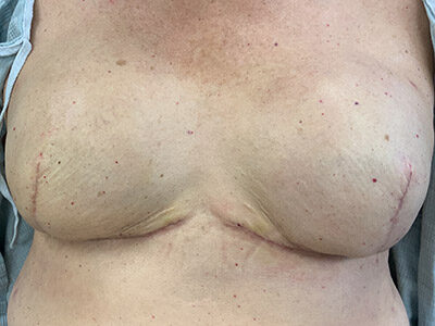 Case # 14 before photo