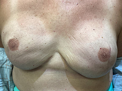 Case # 14 after photo