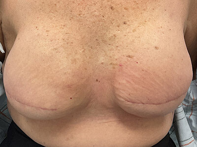 Case # 15 before photo