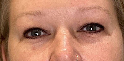 Case # 16 before photo