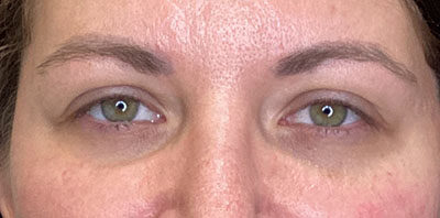 Case # 17 before photo