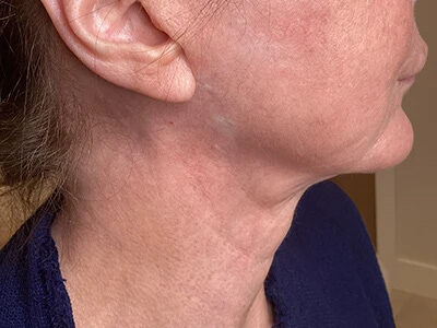 Case # 19 before photo