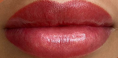 Case # 20 after photo