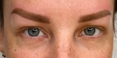 Case # 21 after photo