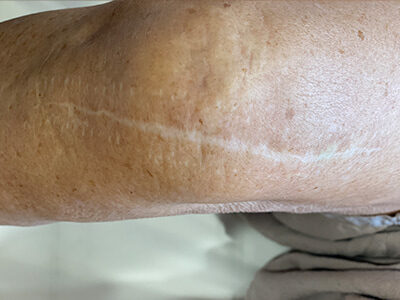 Case # 22 before photo