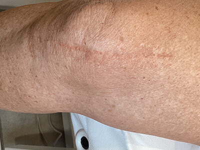 Case # 22 after photo