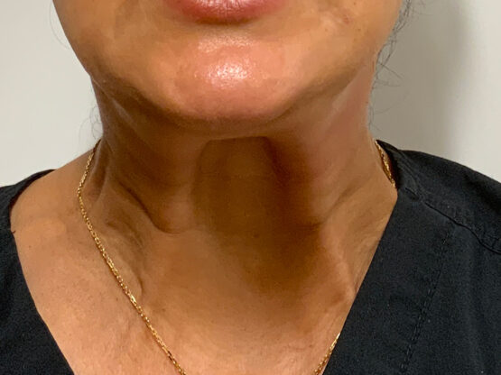 Case # 31 before photo