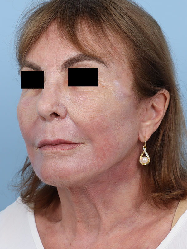 bna image