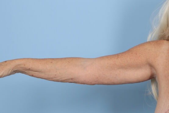 Case # 7 after photo