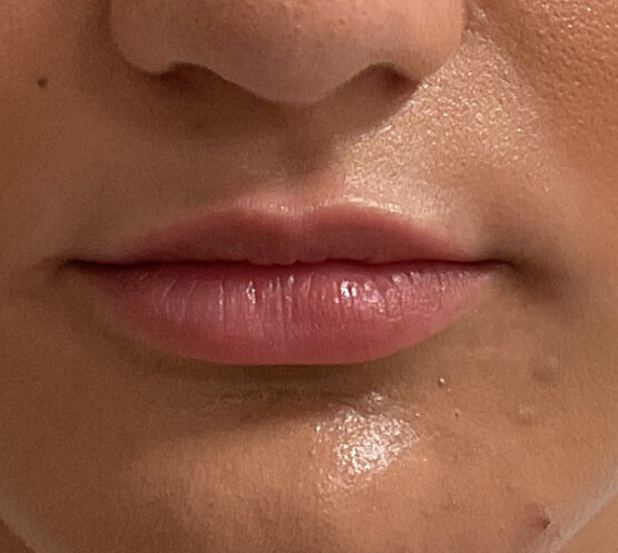 Case # 29 before photo