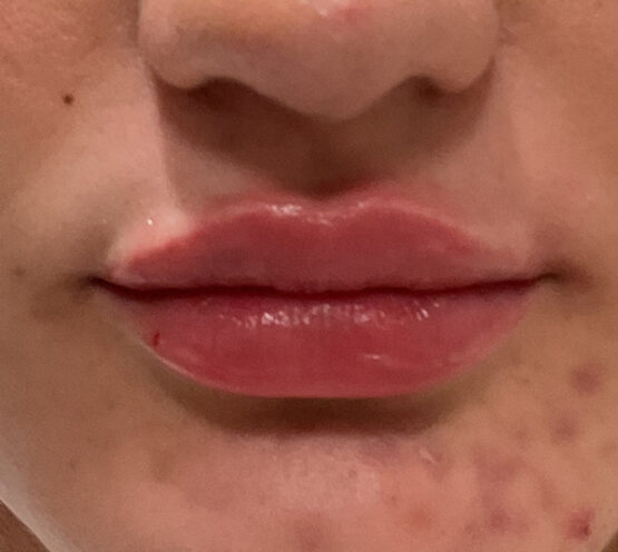 Case # 29 after photo