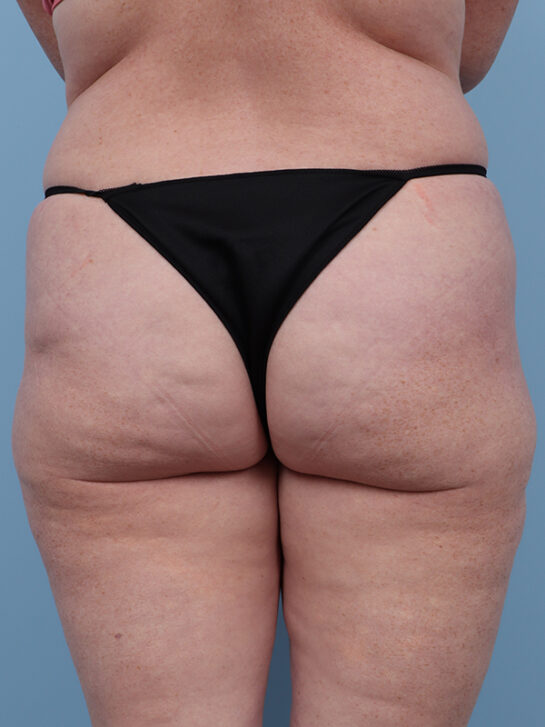 Case # 1 before photo