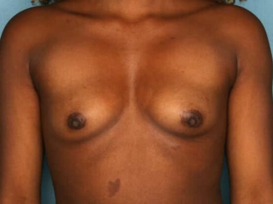 Case # 9 before photo