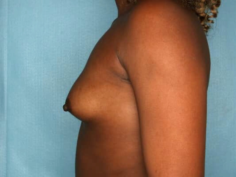 bna image