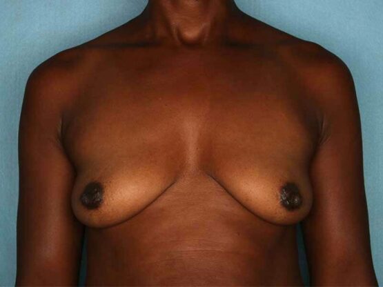 Case # 15 before photo