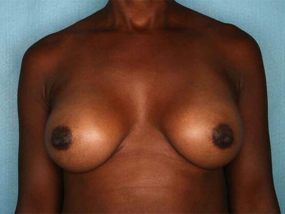 Case # 15 after photo