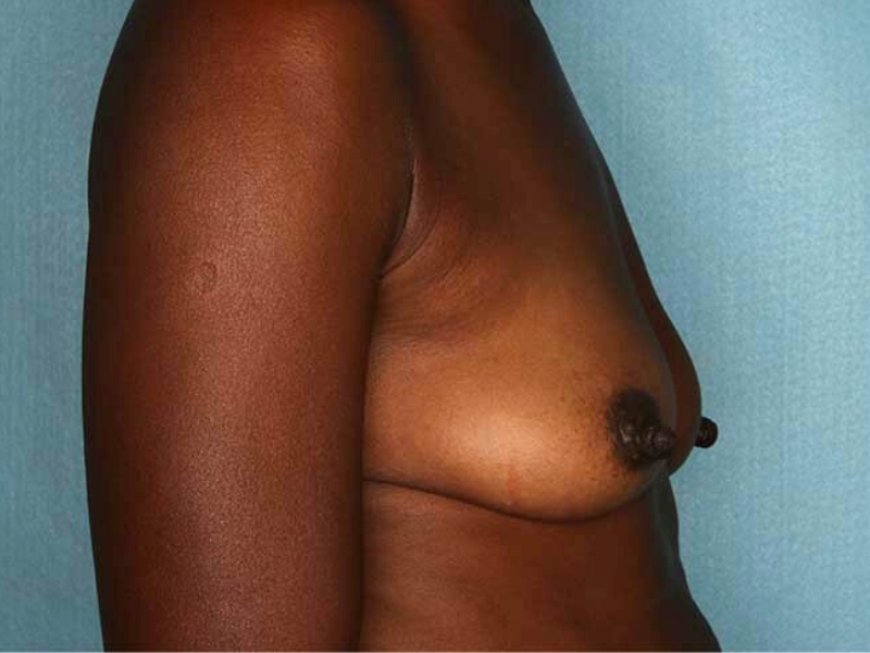 bna image